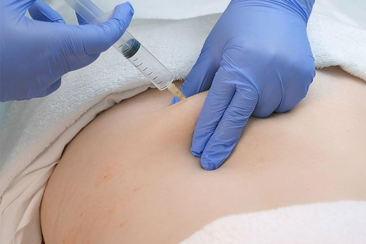 神経ブロック注射